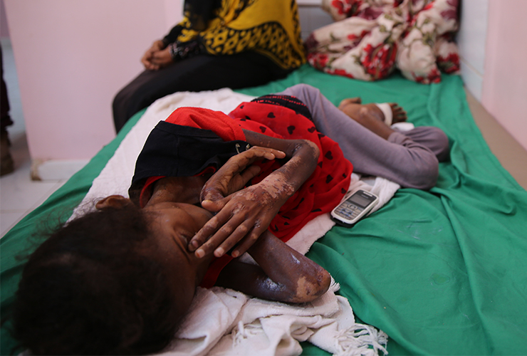 "قمت بزيارة إلى اليمن، الوضع هناك غاية في السوء"